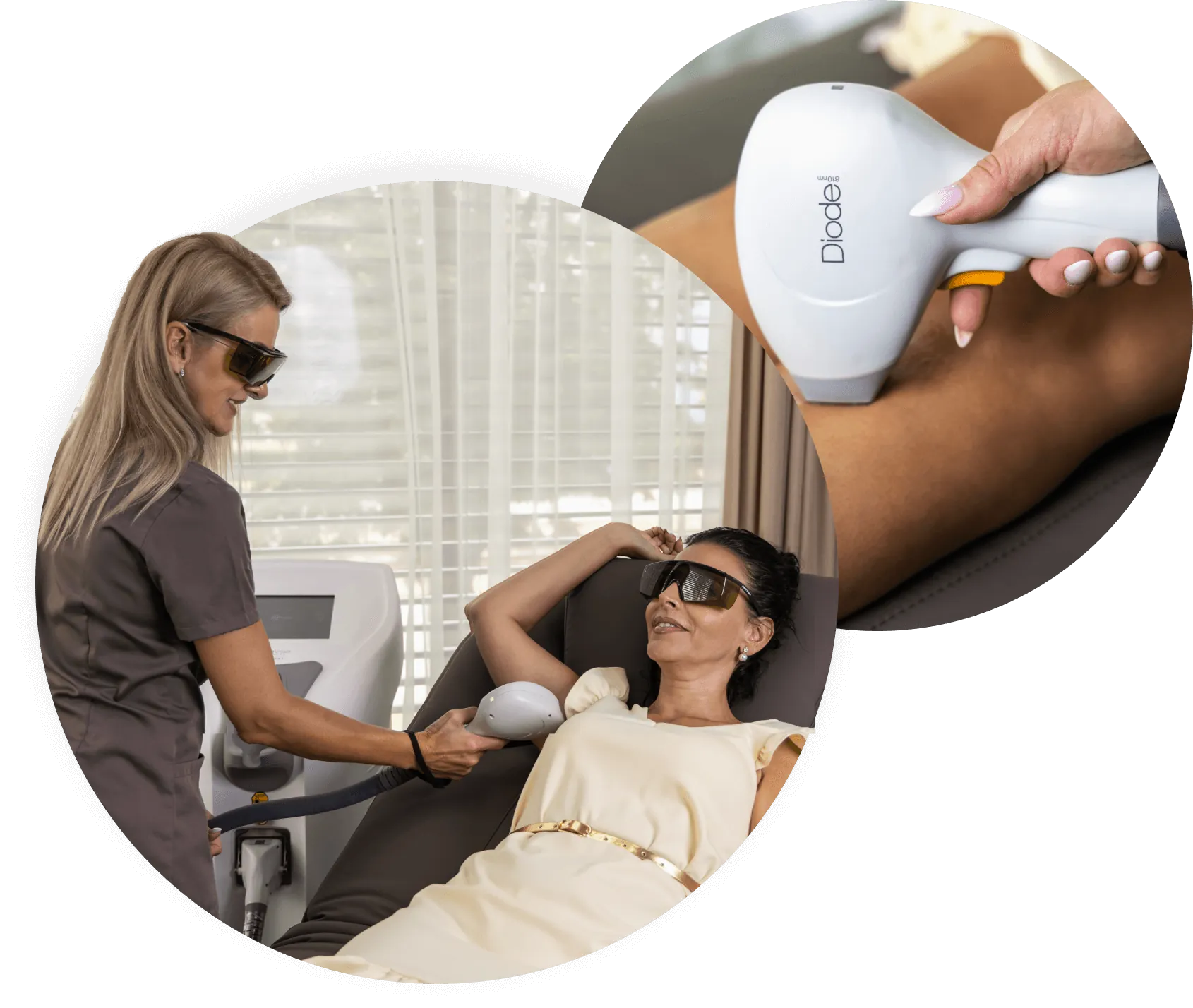 Laserová epilácia medicínskym laserom Prime Lase
